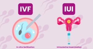 IVF vs IUI