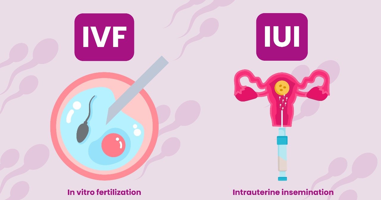 IVF vs IUI